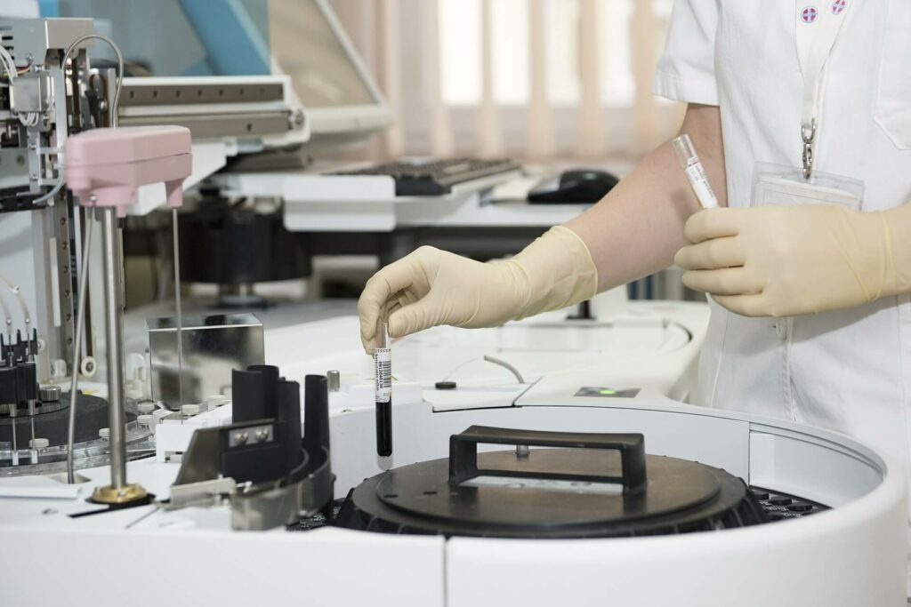 laboratoryjne testy hiv